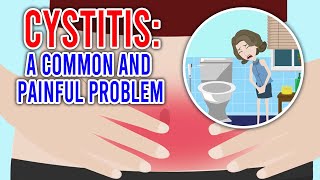 CYSTITIS Its Causes Symptoms and Treatment [upl. by Schnabel259]