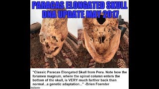 DNA Testing Of Paracas Peru Elongated Skulls May 2017 Update [upl. by Florenza812]