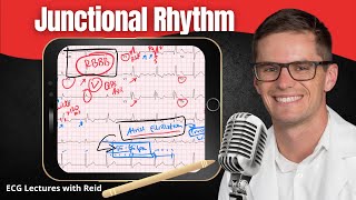 Junctional Rhythms EKG  ECG Lecture [upl. by Donahue991]