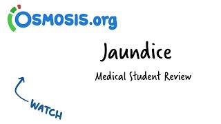 Jaundice  Clinical Presentation [upl. by Assenat96]