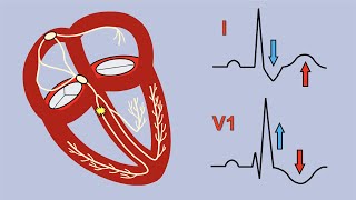 Right Bundle Branch Block and Bifascicular Block [upl. by Dael497]