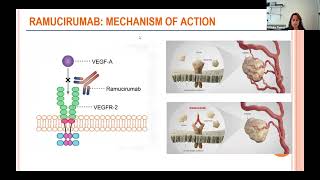 Clinical Trials for Thymic Tumors 2024 Update [upl. by Atiana]