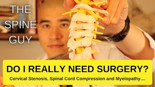 Cervical Stenosis Spinal Cord Compression and Myelopathy DO I REALLY NEED SURGERY [upl. by Mehta]