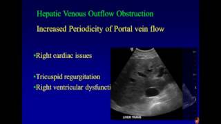 Ultrasound Imaging of Portal Hypertension [upl. by Rosenblatt]