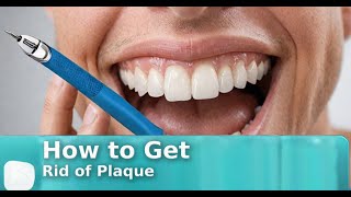 How to Get Rid of Plaque  Dental Health Hub [upl. by Anairol]