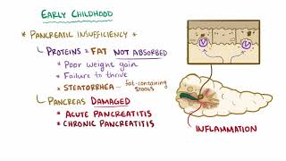 Cystic fibrosis causes symptoms diagnosis treatment amp pathology [upl. by Blair389]