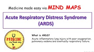 Acute Respiratory Distress SyndromeARDS made easy ARDS Mind map [upl. by Dalila755]