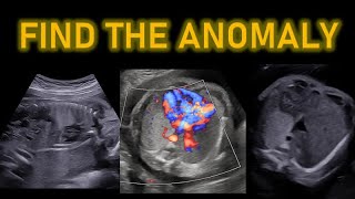 Antenatal Ultrasound Quiz 5  Find the anomaly  With answer [upl. by Xeno]