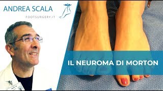 NEUROMA DI MORTON Quali sono le cause i sintomi e i rimedi  NEUROMA DI MORTON TERAPIA [upl. by Ardra334]