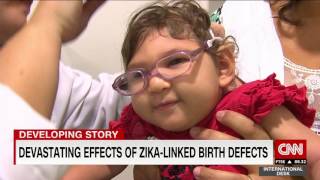 Ground zero of the Zika virus  a look at the babies most affected [upl. by Ateval]