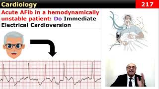 internalmedicine cme usmle محاضراتباطنة ecg كورساتباطنة clinical clinical medicine [upl. by Faletti]