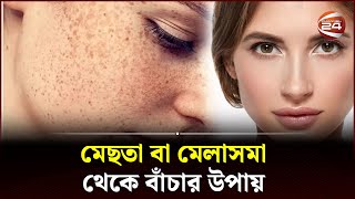 মেছতা বা মেলাসমা থেকে বাঁচার উপায়  Melasma  Skin Care  Channel 24 [upl. by Erreit316]