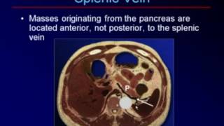 Sonography of the Pancreas and Spleen [upl. by Armillda346]