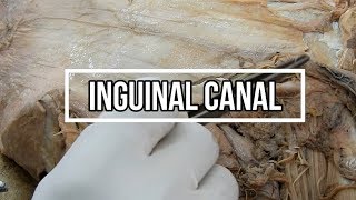 Inguinal Canal [upl. by Eceirtal181]