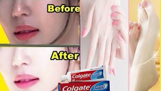 COLGATE TOOTHPASTE FOR FACE WHITENING  LEMON AND COLGATE [upl. by Anirdua]