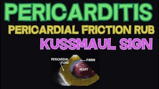 Pericarditis  Pericardial Friction Rub and Kussmaul Sign  EXPLAINED [upl. by Carlene]