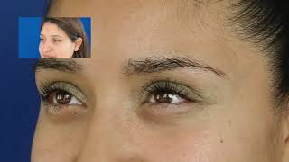 Implante de Cejas Antes y Despues 😎 VIDEO REAL SIN MAQUILLAR EL RESULTADO [upl. by Beilul]