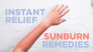 Instant Relief Sunburn Remedies [upl. by Trefler]