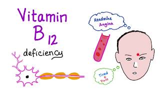 Vitamin B12 Cobalamin Deficiency  Causes Symptoms Diagnosis amp Management  Hematology Series [upl. by Nyrak]