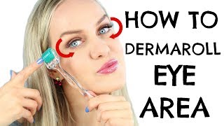 DIY Remove Undereye Bags and Crows Feet with Dermaroller [upl. by Joelie]