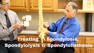 Treating Spondylosis Spondylolysis amp Spondylolisthesis Lumbar Spine [upl. by Matelda]