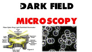 Dark field microscopy [upl. by Ndnarb362]