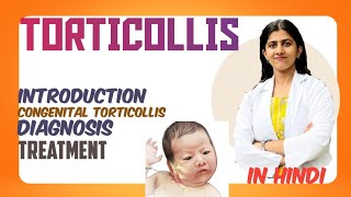 TORTICOLLIS  IN HINDI  ORTHOPAEDICSMAHESWARI  TREATMENT DIAGNOSIS [upl. by Nahtanoy]