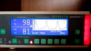 Novametrix 520A [upl. by Alegre]