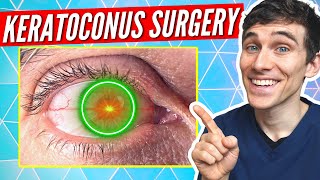 What is Corneal Collagen Crosslinking Keratoconus Treatment Explained [upl. by Sivraj575]