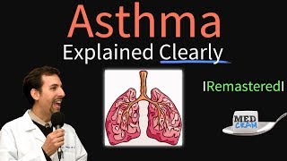 Asthma Explained Clearly Remastered  Pathophysiology Diagnosis Triggers [upl. by Valaria295]