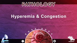 L13 Hyperemia and congestion Pathology [upl. by Coyle]