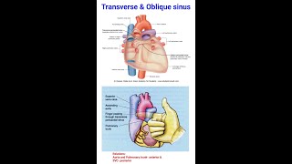 Anatomy of the pericardial sinuses Oblique and transverse sinus [upl. by Ehgit368]