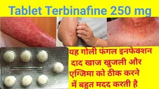 Tablet Terbinafine 250 Mg Full Review In Hindi  Uses  Dose  Side Effects Tarbinafine Tablet Uses [upl. by Eednak]