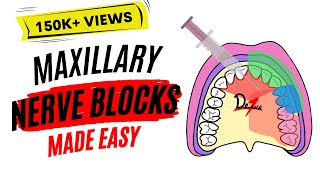 Maxillary Nerve Block Anesthesia For Dental Procedures [upl. by Emyam]