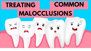 Management of Common Malocclusions Orthodontics [upl. by Melinde283]