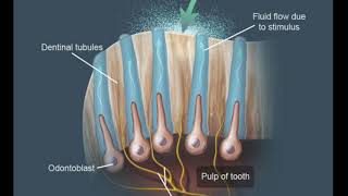 Dentin Hypersensitivity Theories Lecture [upl. by Persse444]