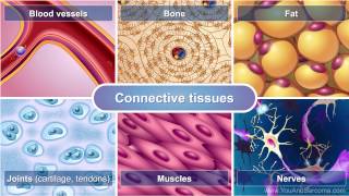 Understanding Soft Tissue Sarcoma [upl. by Odidnac]