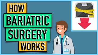 How Bariatric Surgery Works [upl. by Larrad214]