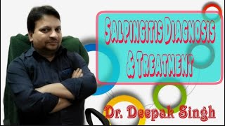 Salpingitis Diagnosis And Treatment Fallopian Tube Inflammation  Oviduct inf Dr Deepak Singh [upl. by Barnaby]