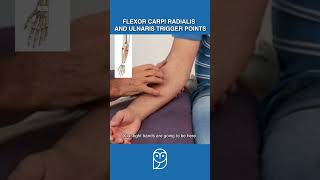 Is Your Wrist Pain Caused By Trigger Points In the Forearm Flexors [upl. by Auqenat]