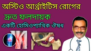 Osteoarthritis রোগের দ্রুত ফলদায়ক হোমিওপ্যাথিক ঔষধ  dr sp goswami [upl. by Reed]