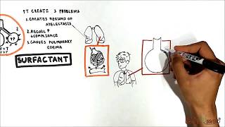 Lung Recoil components surfactant LaPlace Respiratory distress syndrome [upl. by Melantha]