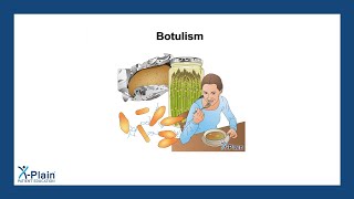 Botulism [upl. by Hewet]