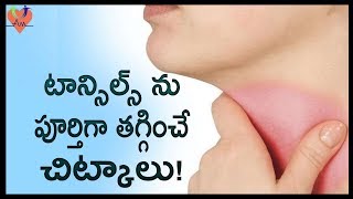 టాన్సిల్స్ ను పూర్తిగా తగ్గించే చిట్కాలు   Best Natural Home Remedies To Cure Tonsillitis  Arogya [upl. by Ekralc]