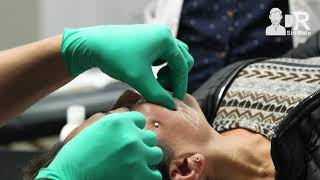 Capacitación de aplicación de hilo facial PDO tensores mágicos colágeno lisos espiculados DrSinBata [upl. by Eimareg]