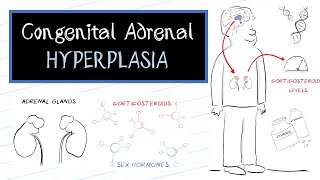 What is Congenital Adrenal Hyperplasia CAH [upl. by Leblanc]