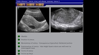 Ultrasound Course of Gynecology Part 01 [upl. by Bekelja]