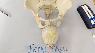 Fetal Skull and Maternal pelvis Obstetric Revision👍 [upl. by Anahsar846]