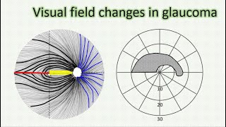 RS Vision Pathway Part 4  Chiasmal Segment [upl. by Waddell]