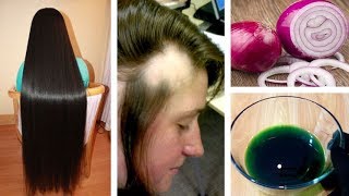 Get Long Thicken HAIR Onion amp Ginger Oil  Magical Home Remedy to Hair Regrowth Urdu Hindi [upl. by Llenrrad47]